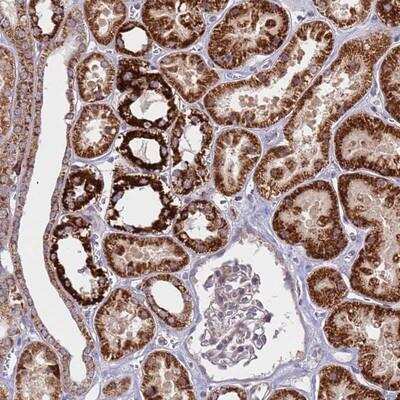 Immunohistochemistry-Paraffin: CES7 Antibody [NBP2-14472]