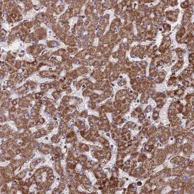 Immunohistochemistry-Paraffin: CES7 Antibody [NBP2-14472]