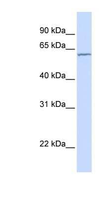 Western Blot: CES7 Antibody [NBP1-70498]