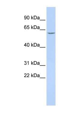 Western Blot: CES7 Antibody [NBP1-70499]