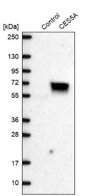 Western Blot: CES7 Antibody [NBP2-14472]