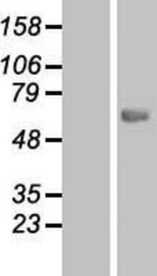 Western Blot: CES7 Overexpression Lysate [NBP2-05514]