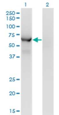 Western Blot: CESK1 Antibody (1G8) [H00150160-M09]