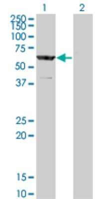 Western Blot: CESK1 Antibody (2C9) [H00150160-M12]