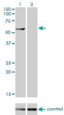 Western Blot: CESK1 Antibody (4G6) [H00150160-M01]