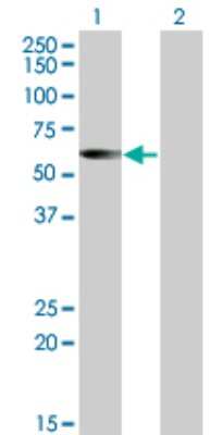 Western Blot: CESK1 Antibody (4G6) [H00150160-M01]