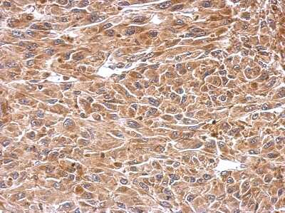 Immunohistochemistry-Paraffin: CESK1 Antibody [NBP2-15865]