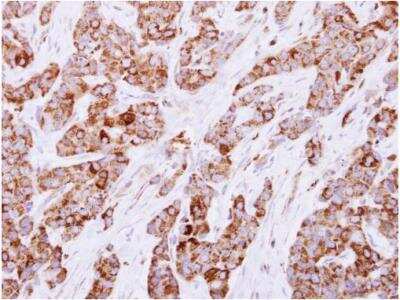 Immunohistochemistry-Paraffin: CESK1 Antibody [NBP2-15866]