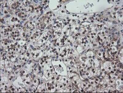 Immunohistochemistry: CESK1 Antibody (OTI1C1) - Azide and BSA Free [NBP2-72414]
