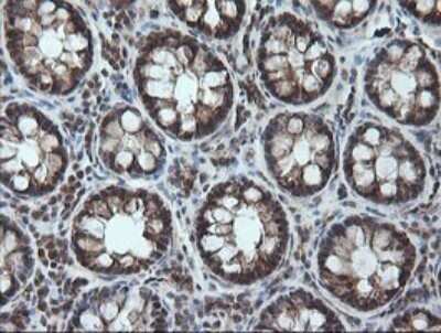 Immunohistochemistry: CESK1 Antibody (OTI1C1) - Azide and BSA Free [NBP2-72414]