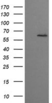 Western Blot: CESK1 Antibody (OTI1C1)Azide and BSA Free [NBP2-72414]