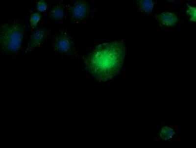 Immunofluorescence: CESK1 Antibody (OTI1C1) [NBP2-46114]
