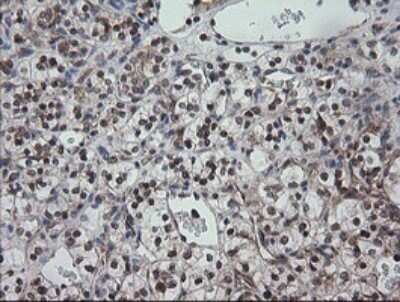 Immunohistochemistry: CESK1 Antibody (OTI1C1) [NBP2-46114]