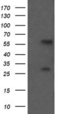 Western Blot: CESK1 Antibody (OTI2A5)Azide and BSA Free [NBP2-72413]