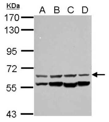 Western Blot: CESK1 Antibody [NBP2-15865]