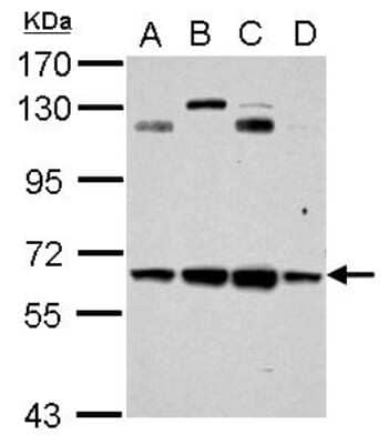 Western Blot: CESK1 Antibody [NBP2-15866]