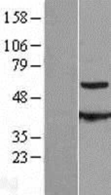 Western Blot: CESK1 Overexpression Lysate [NBL1-08904]