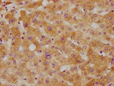 Immunohistochemistry: CETP Antibody (2F1) [NBP3-15191]