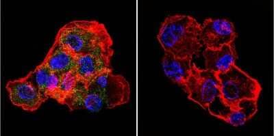 Immunocytochemistry/ Immunofluorescence: CETP Antibody (ATM192) - BSA Free [NB300-558]