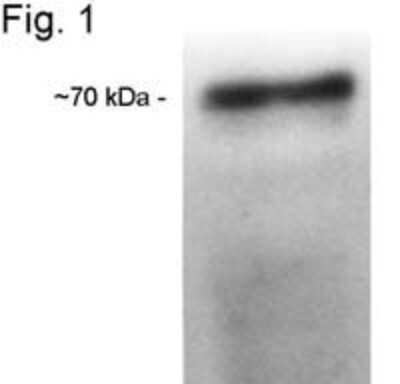 Western Blot: CETP Antibody (ATM192)BSA Free [NB300-558]