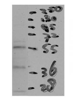 Western Blot: CETP Antibody [NBP1-57982]