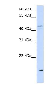 Western Blot: CETP Antibody [NBP1-58015]