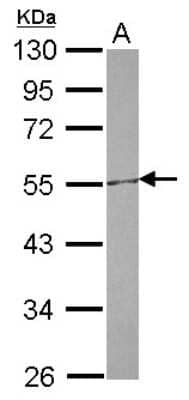 Western Blot: CETP Antibody [NBP2-15867]