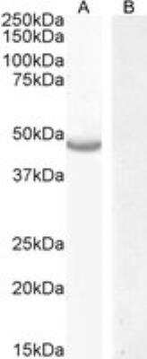 Western Blot: CETP Antibody [NBP3-11019]