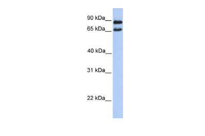 Western Blot: CFAP157 Antibody [NBP2-84665]