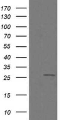 Western Blot: CFAP299 Antibody (OTI1A6)Azide and BSA Free [NBP2-72466]