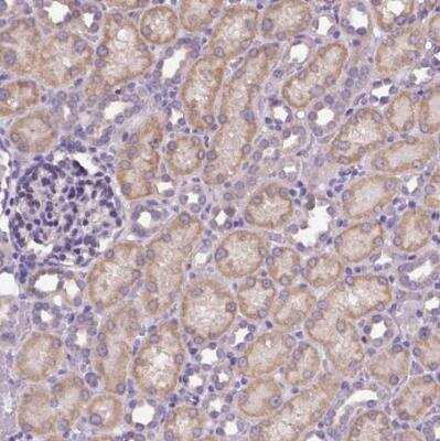 Immunohistochemistry-Paraffin: CFAP54 Antibody [NBP1-90737]