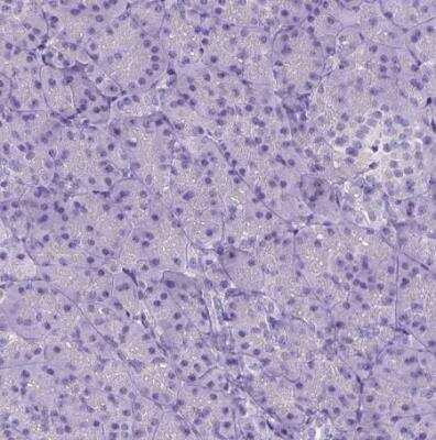 Immunohistochemistry-Paraffin: CFAP54 Antibody [NBP1-90737]