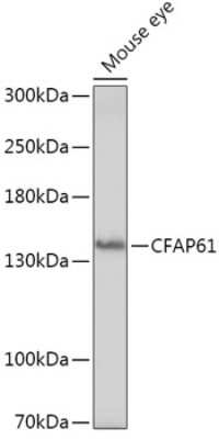 Western Blot: CFAP61 AntibodyAzide and BSA Free [NBP2-92398]