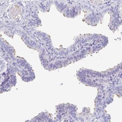 Immunohistochemistry-Paraffin: CFAP69 Antibody [NBP2-32373]