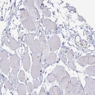 Immunohistochemistry-Paraffin: CFAP69 Antibody [NBP2-32373]