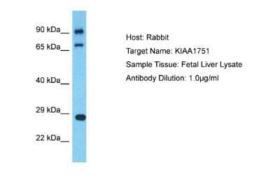 Western Blot: CFAP74 Antibody [NBP2-87180]