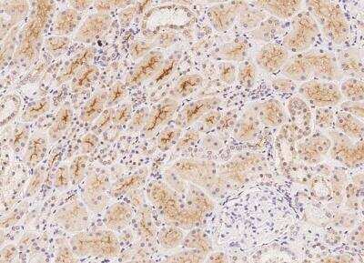 Immunohistochemistry-Paraffin: CFAP97D1 Antibody [NBP3-05930]