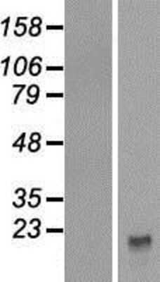 Western Blot: CYRPTIC/CFC1 Overexpression Lysate [NBP2-06009]