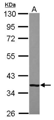 Western Blot: Complement Factor H-related 1/CFHR1/CFHL1 Antibody [NBP2-15868]