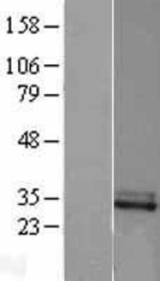 Western Blot: Complement Factor H-related 2/CFHR2/CFHL2 Overexpression Lysate [NBL1-09123]