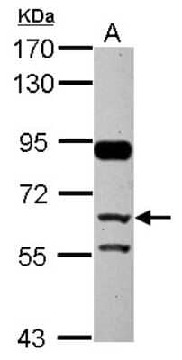 Western Blot: Complement Factor H-related 5/CFHR5 Antibody [NBP2-14912]