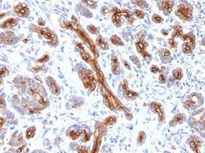 Immunohistochemistry-Paraffin: CFTR Antibody (CFTR/1341) [NBP2-53369]