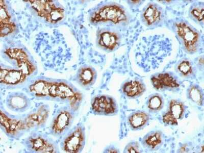 Immunohistochemistry-Paraffin: CFTR Antibody (CFTR/1342) - Azide and BSA Free [NBP2-54505]