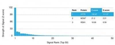 Protein Array: CFTR Antibody (CFTR/1643) - Azide and BSA Free [NBP2-54509]