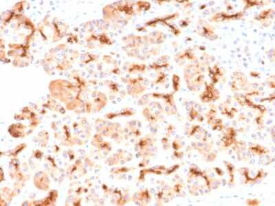 Immunohistochemistry-Paraffin: CFTR Antibody (CFTR/2290R) [NBP3-07496]