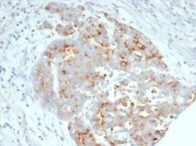 Immunohistochemistry-Paraffin: CFTR Antibody (CFTR/7003R) [NBP3-13843]