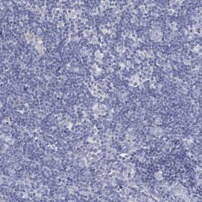 Immunohistochemistry-Paraffin: CFTR Antibody [NBP3-16990]