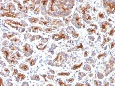 Immunohistochemistry-Paraffin: CFTR Antibody (SPM176) [NBP2-53373]