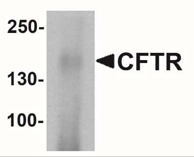 Western Blot: CFTR AntibodyBSA Free [NBP2-41265]