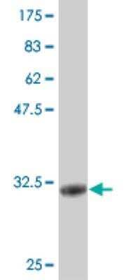 Western Blot: CGB2 Antibody (4F8) [H00114336-M02]